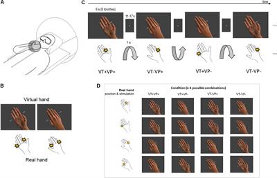 Fronto-Parietal Brain Responses to Visuotactile Congruence in an Anatomical Reference Frame